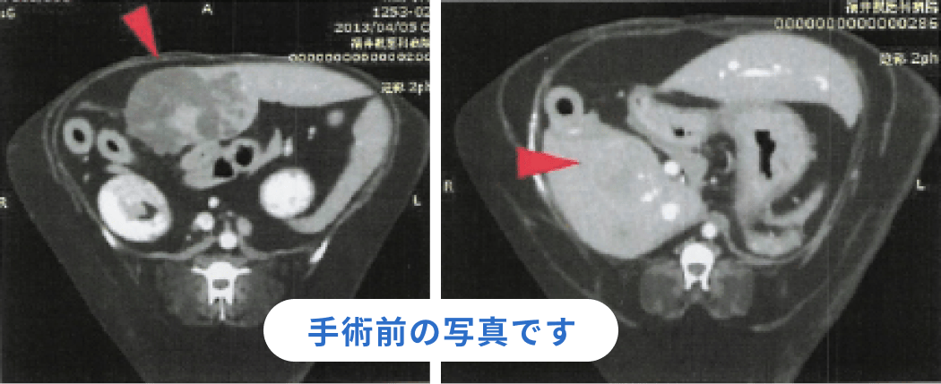 手術前の画像