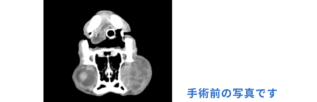 手術前の画像